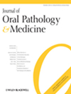 Journal Of Oral Pathology & Medicine期刊封面